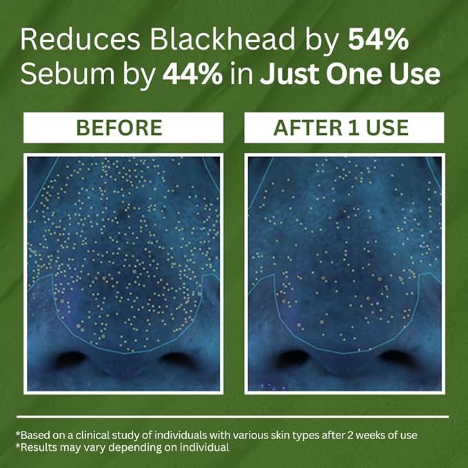 Basil Glow Mask | Deep Cleansing, Revitalizing Formula 6