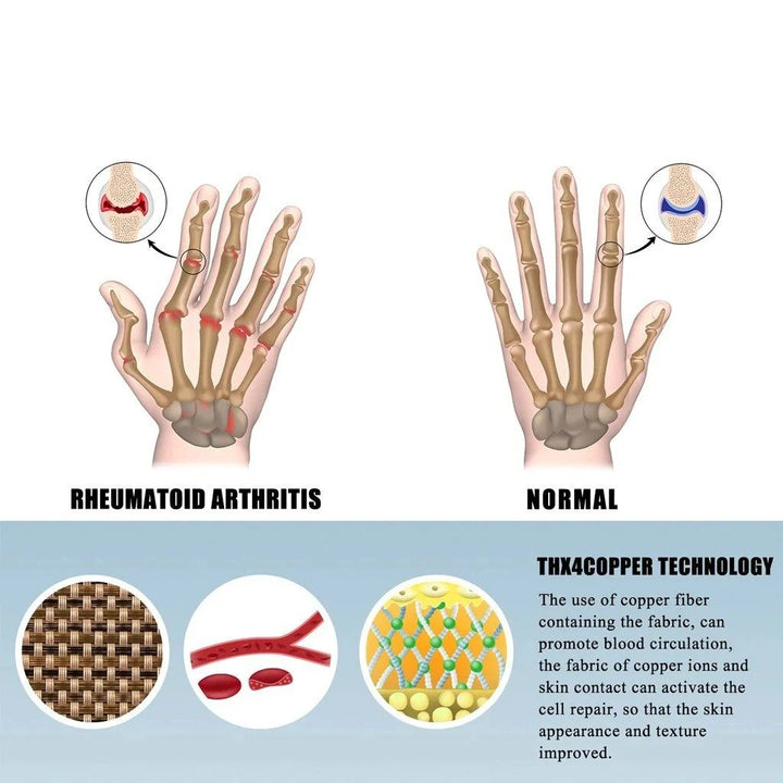Astra Compression Gloves | Soft Cotton-Spandex for Arthritis Relief 4