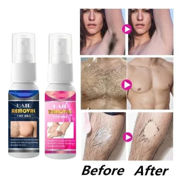 Breezy Hair Removal Spray | Fast-Acting Depilatory for Men 0