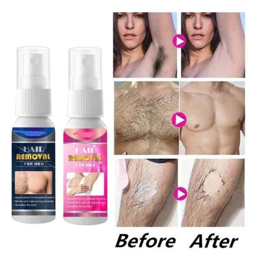 Breezy Hair Removal Spray | Fast-Acting Depilatory for Men 0