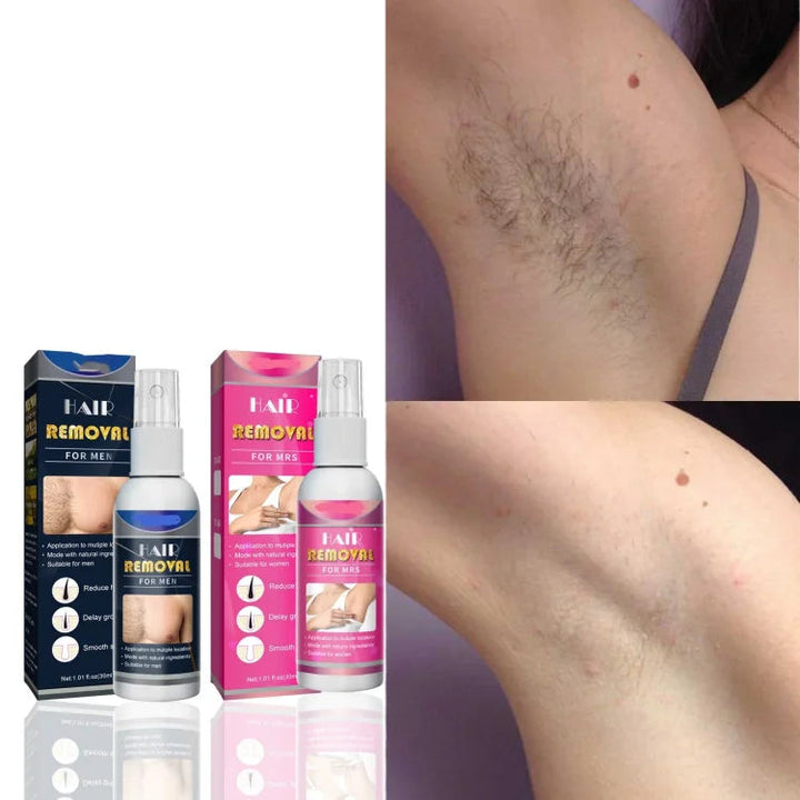 Breezy Hair Removal Spray | Fast-Acting Depilatory for Men 4