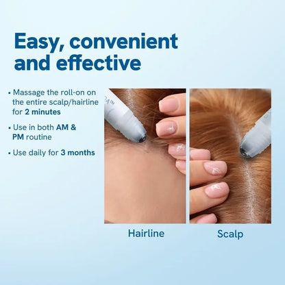 Felicity Hair Growth Serum | Follicle Activator with Precision Roller, DHT Blockers 2