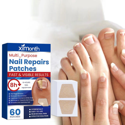 Fungal Revive Nail Treatment Patches | Targeted Repair for Nail Fungus, 60 Pieces 1