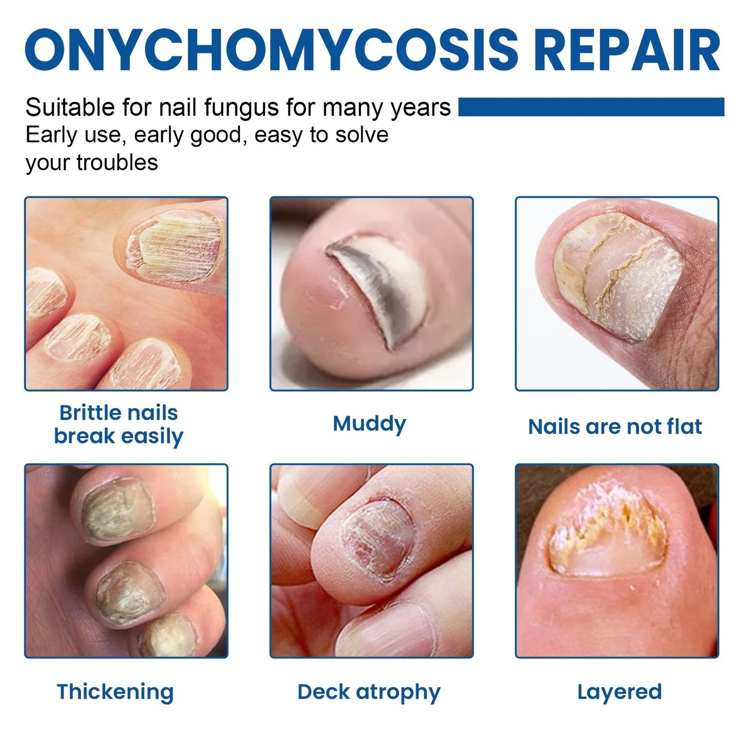 Fungal Revive Nail Treatment Patches | Targeted Repair for Nail Fungus, 60 Pieces 3