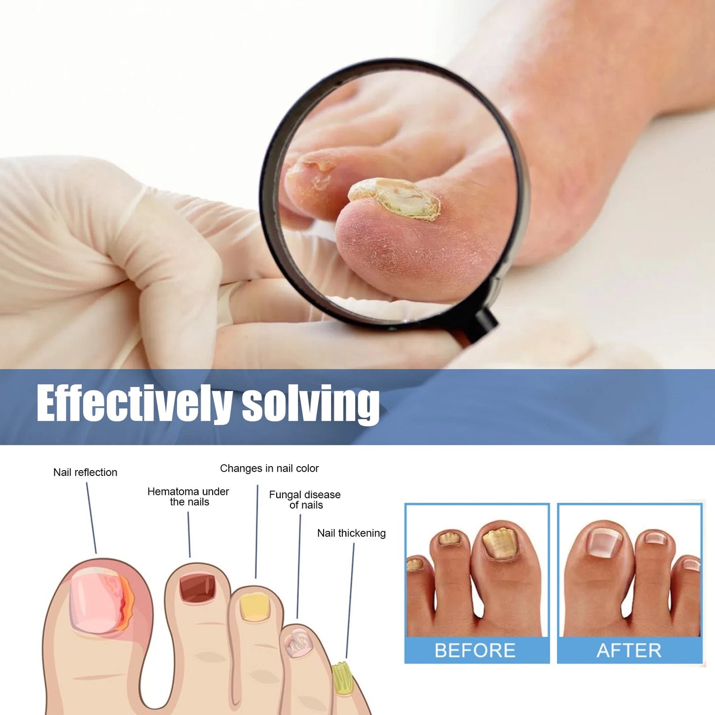 Fungal Revive Nail Treatment Patches | Targeted Repair for Nail Fungus, 60 Pieces 7