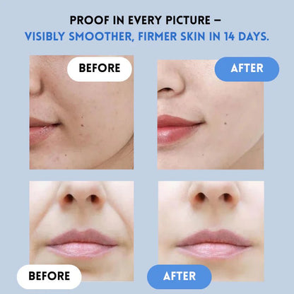 GloLift Instant Strips | Deep Hydration, Easy Application 3