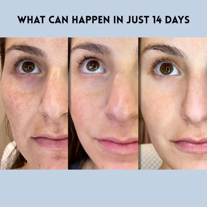 GloLift Instant Strips | Deep Hydration, Easy Application 5
