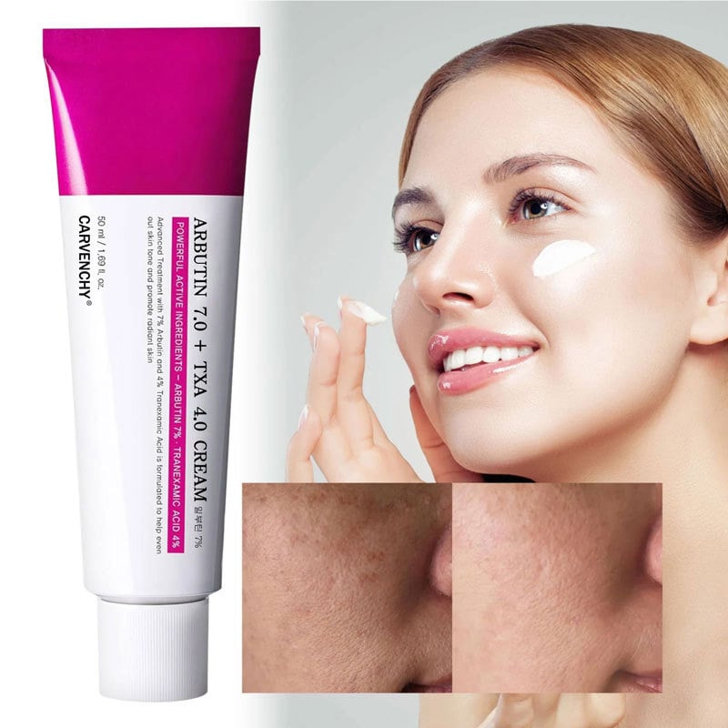 Radiance Skin Serum | Vitamin C & Niacinamide for Dark Spot Correction 4