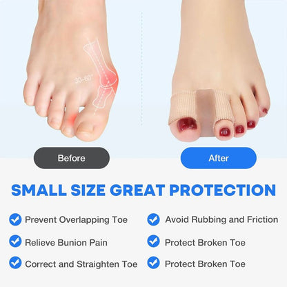 Tova Toe Spacers | Silicone Separators for Bunions, Invisible Comfort 5