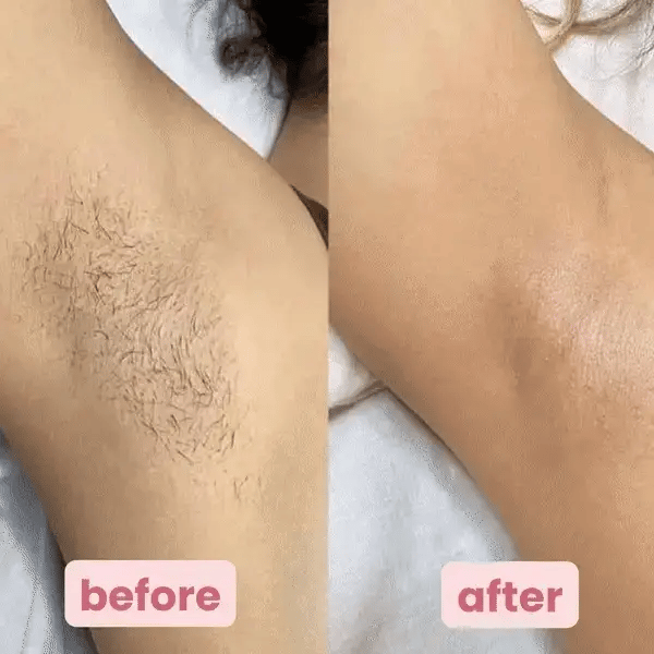 Vera Electric Razor | 2-in-1 Waterproof, Gentle on Sensitive Skin 4