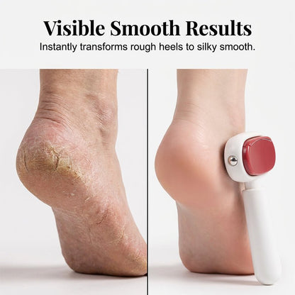 Dailystep Dual Surface Foot Smoother Product Image 03