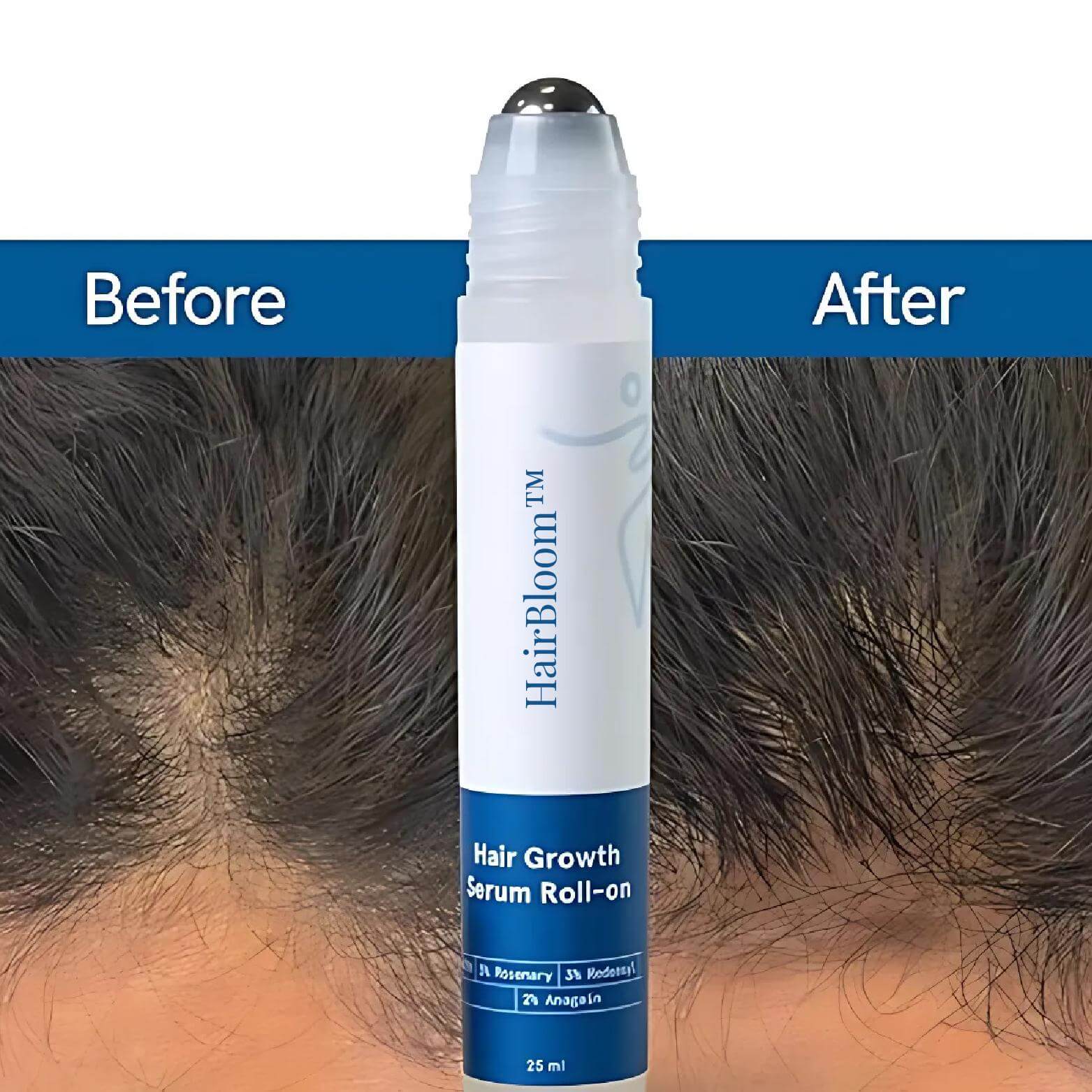 Herbal Scalp Roll On Serum Product Image 01